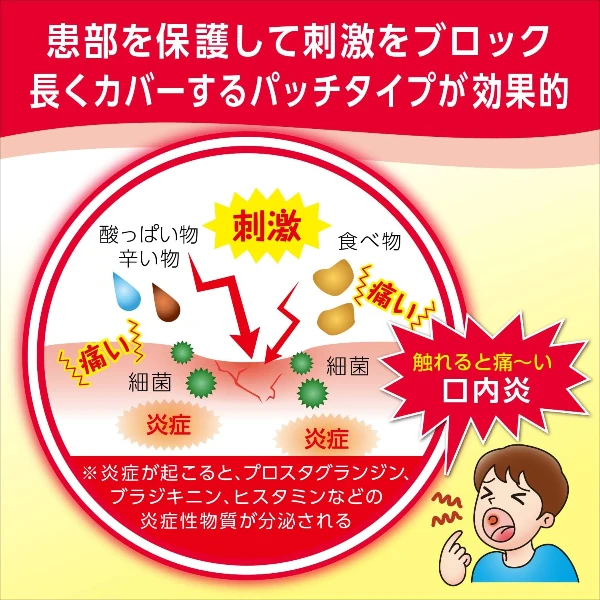白款-大正製藥口內炎口腔潰瘍A貼片10枚【第3類醫藥品】