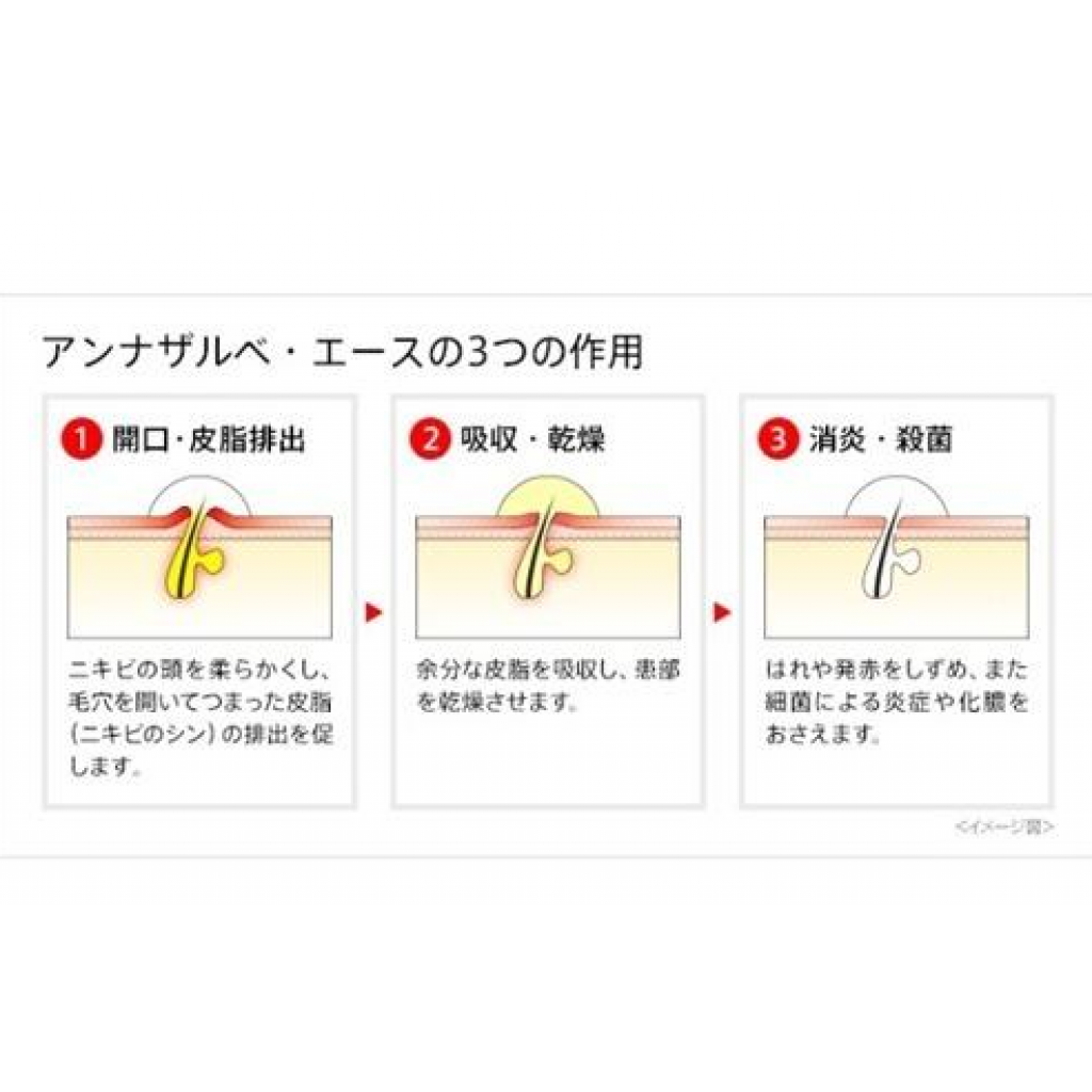 日本白兔牌SS製藥 青春痘痘藥膏 18g【第2類醫藥品】